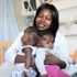 Twin girls joined at head separated in rare surgery