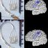 First ‘plug and play’ brain prosthesis demoed in paralysed individual