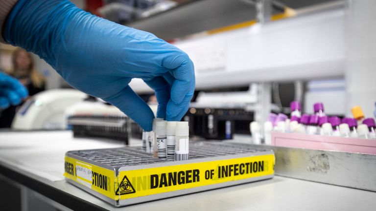 GLASGOW, SCOTLAND - FEBRUARY 19: Clinical support technician Douglas Condie extracts viruses from swab samples so that the genetic structure of a virus can be analysed and identified in the coronavirus testing laboratory at Glasgow Royal Infirmary, on February 19, 2020 in Glasgow, Scotland. (Photo by Jane Barlow - WPA Pool/Getty Images) 